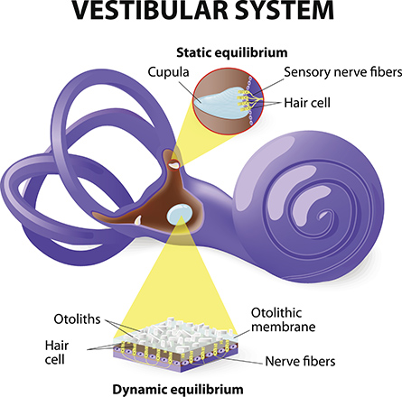 vestibular rehabilitation